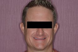 Figure 2: Provisionals, before Figure 2: Provisionals, before