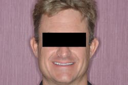 Figure 3: Provisionals, after Figure 3: Provisionals, after