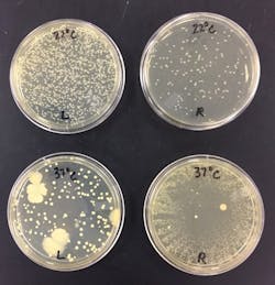 Figure 4: Inoculated plates from personal-use utility gloves at 22°C (top row, room temperature) and 37°C (bottom row, human body temperature) Figure 4: Inoculated plates from personal-use utility gloves at 22°C (top row, room temperature) and 37°C (bottom row, human body temperature)