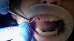 Swedish Wonder Thumb 5ddd3de593ea8 Swedish Wonder Thumb 5ddd3de593ea8