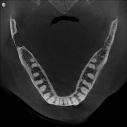 Figure 1: 3-D axial view Figure 1: 3-D axial view