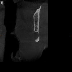 Figure 2: 3-D cross-sectional Figure 2: 3-D cross-sectional