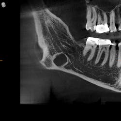 Figure 3: 3-D longitudinal Figure 3: 3-D longitudinal