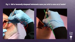 Fig 3 Wrist Neutral Not Neutral Fig 3 Wrist Neutral Not Neutral