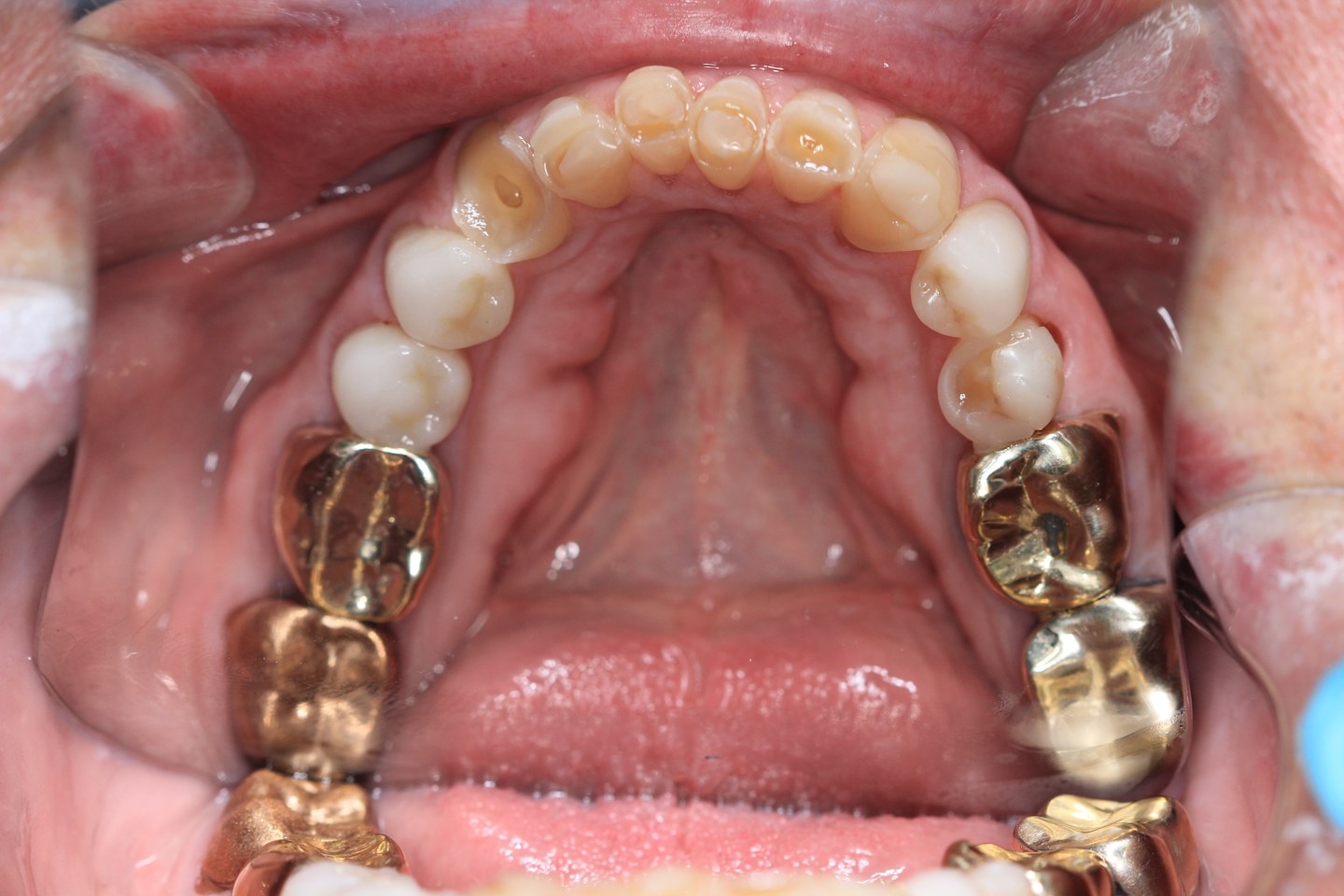 Take this patient and let’s see how your treatment plan compares to