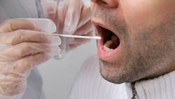 Saliva Test 5e4323bd316e1 Saliva Test 5e4323bd316e1