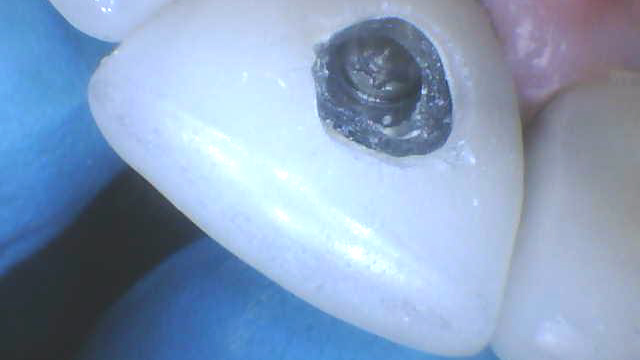 20 Mar26 B Cgiv03 Primary 5e78dc1fc7f5e