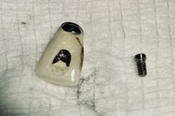 Figure 6: Crown and old screw Figure 6: Crown and old screw