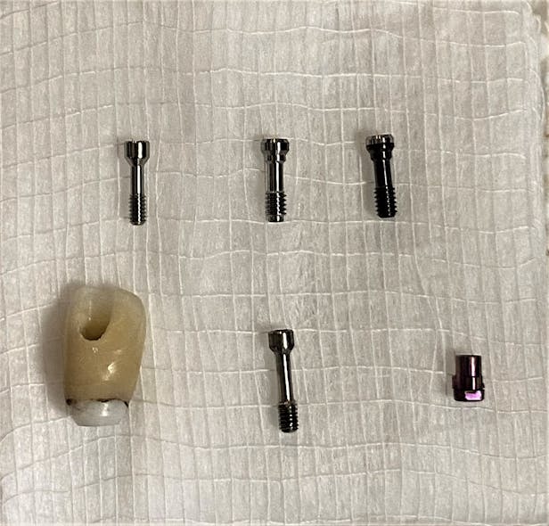 Figure 7: Comparison of different screws on hand in an attempt to match the existing screw
