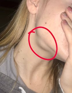 Figure 1: Patient presentation Figure 1: Patient presentation