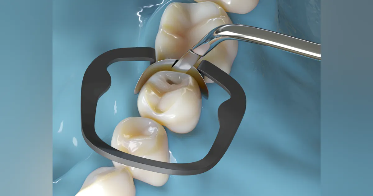 Acro Instruments Why premium instrumentation matters in restorative dentistry | Dentistry IQ