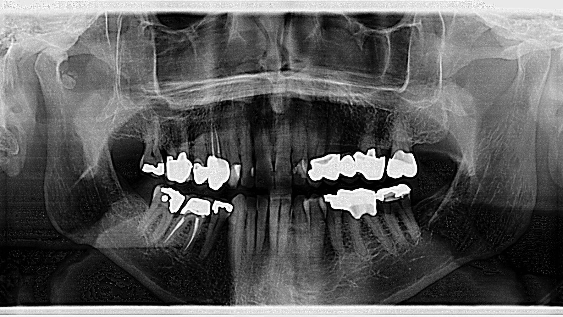 PANORAMIC RADIOLOGY SECOND EDITION　歯列矯正 PANORAMIC RADIOLOGY SECOND EDITION 歯列矯正
