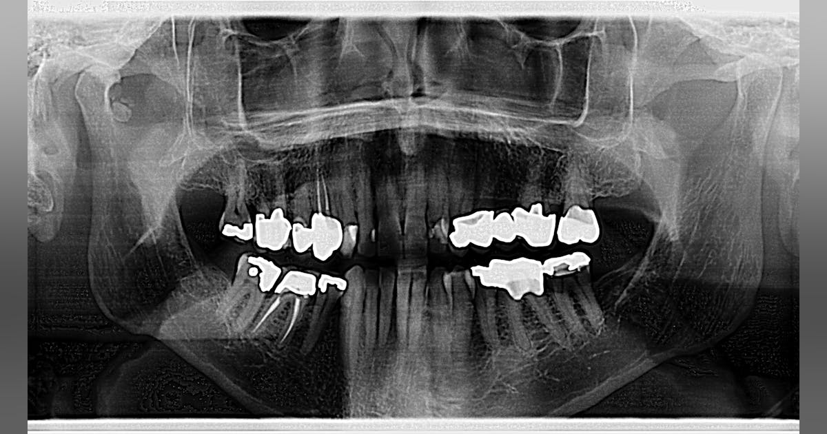 BC oral pathology case no. 47: Incidental radiographic finding in the ...