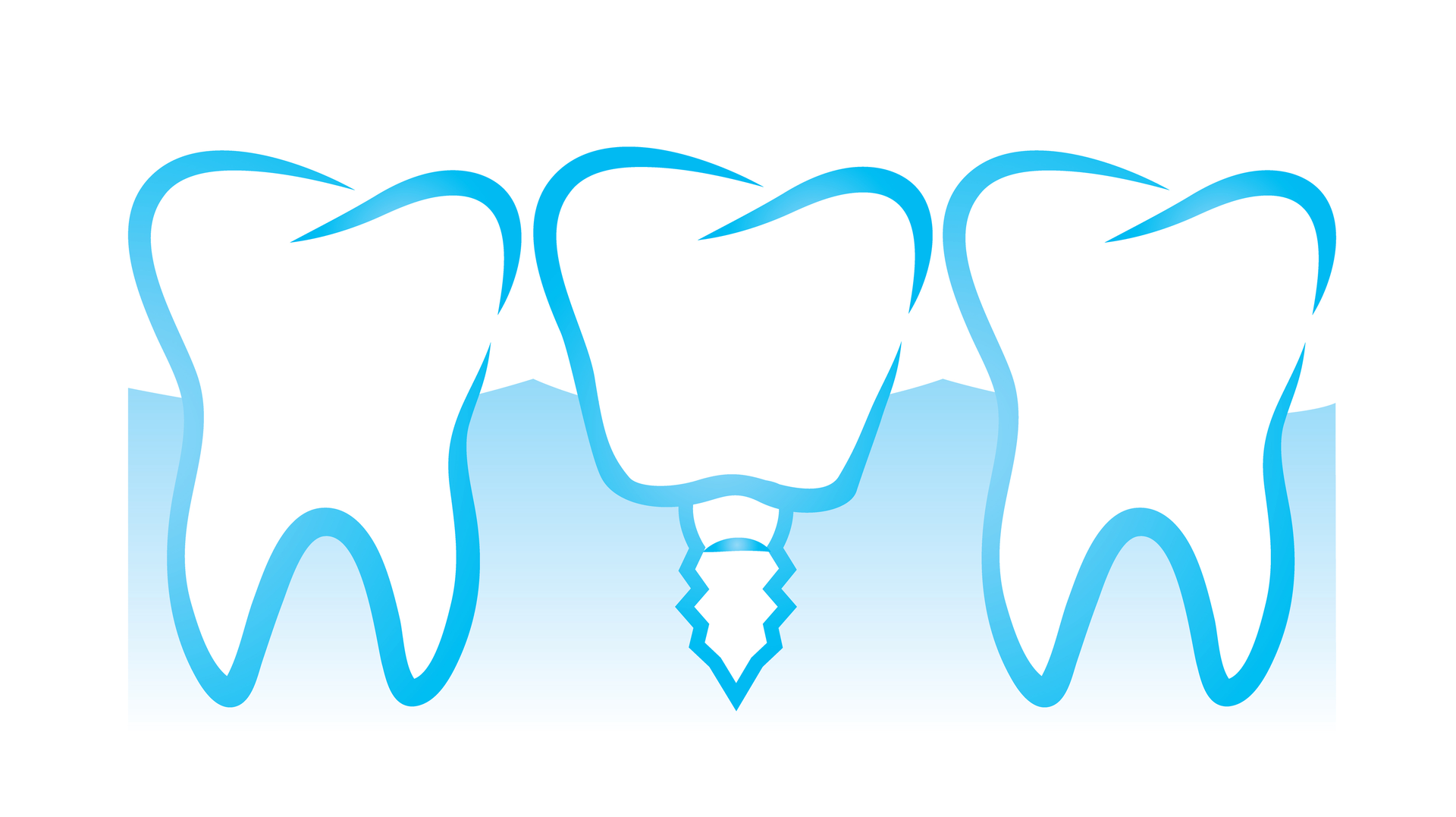 Copyright Polina Elyutina Dreamstime Implant Illustration 5f209538c5465