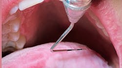 Photo courtesy of Stacey L. Gividen, DDS. Photo courtesy of Stacey L. Gividen, DDS.