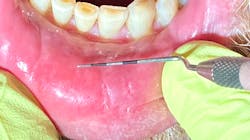 Img 9605 5f69015a1969b Img 9605 5f69015a1969b