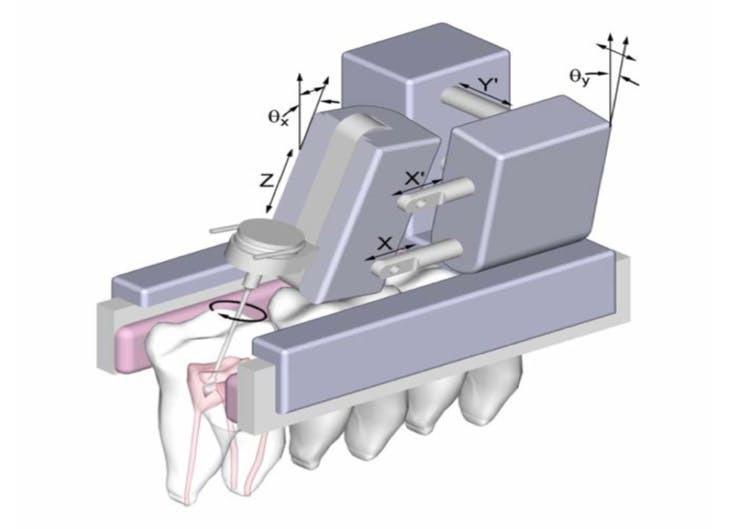 Micromachine for automatic endodontic treatment.