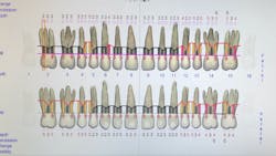 Photo courtesy of Pamela Maragliano-Muniz, DMD Photo courtesy of Pamela Maragliano-Muniz, DMD