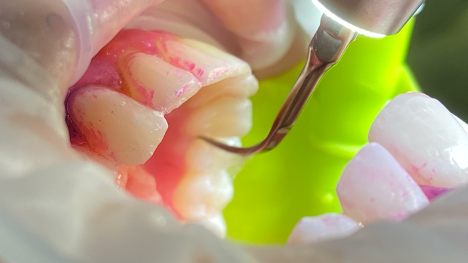 Picture2 5f7c7b235cc4e