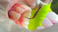 Picture2 5f7c7b235cc4e Picture2 5f7c7b235cc4e