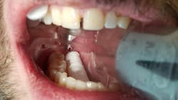 Iso Cotton 5f75f06da8c1b Iso Cotton 5f75f06da8c1b