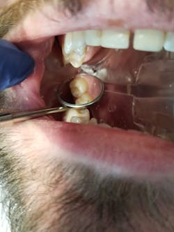 Isodry gives me an extra set of hands, because it takes care of suction and retraction. Isodry gives me an extra set of hands, because it takes care of suction and retraction.