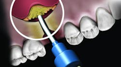 Novabone Sinus Blue 2017 6011e15f01944 Novabone Sinus Blue 2017 6011e15f01944