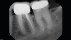 Screen Shot 2021 01 26 At 9 16 08 Am 60103246219f6 Screen Shot 2021 01 26 At 9 16 08 Am 60103246219f6