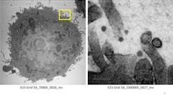 In electron microscope images captured during the study, SARS-CoV-2 was seen not attaching to cell walls in the presence of xylitol.