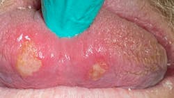 Img 7619 6078b3bfd5bef Img 7619 6078b3bfd5bef