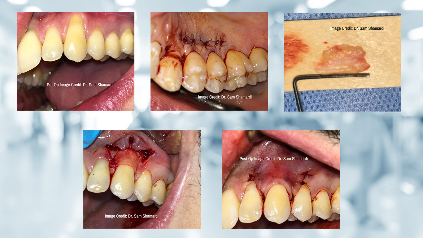 Auger Clinical Collaborations 2 608078d6ae15b
