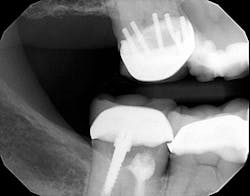 Ttl How Many Pins Do You See 1 Ttl How Many Pins Do You See 1