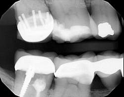 Ttl How Many Pins Do You See 2 Ttl How Many Pins Do You See 2