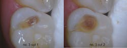 Fig2 Fig3 Fig2 Fig3