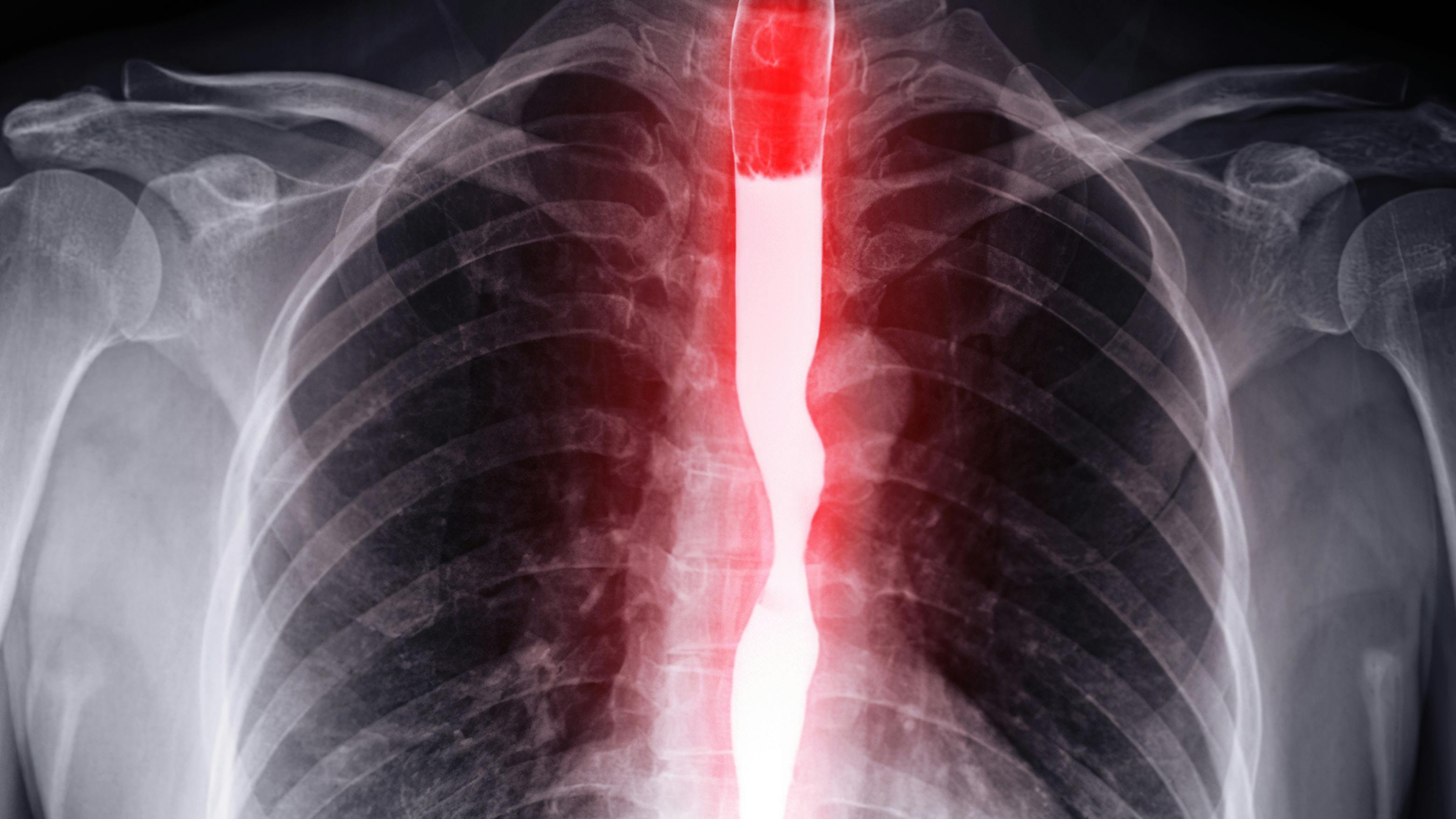 Dreamstime Xxl 161522023 60e71a91a7e5d