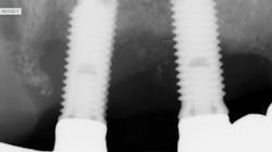 Screen Shot 2021 08 20 At 1 50 44 Pm 611ffbe14d438 Screen Shot 2021 08 20 At 1 50 44 Pm 611ffbe14d438