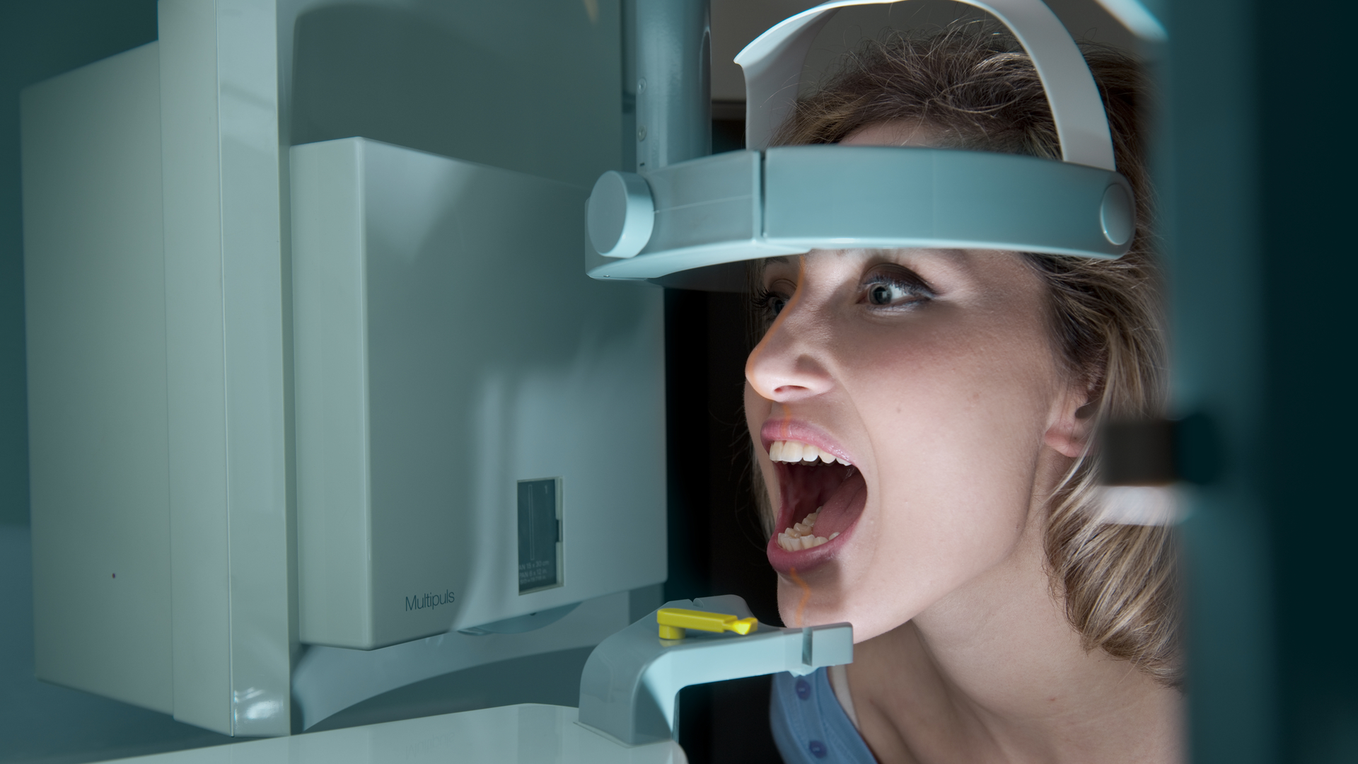 X Rays 6197cadc3d670