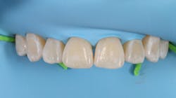 Fig 4 61eae82480309 Fig 4 61eae82480309