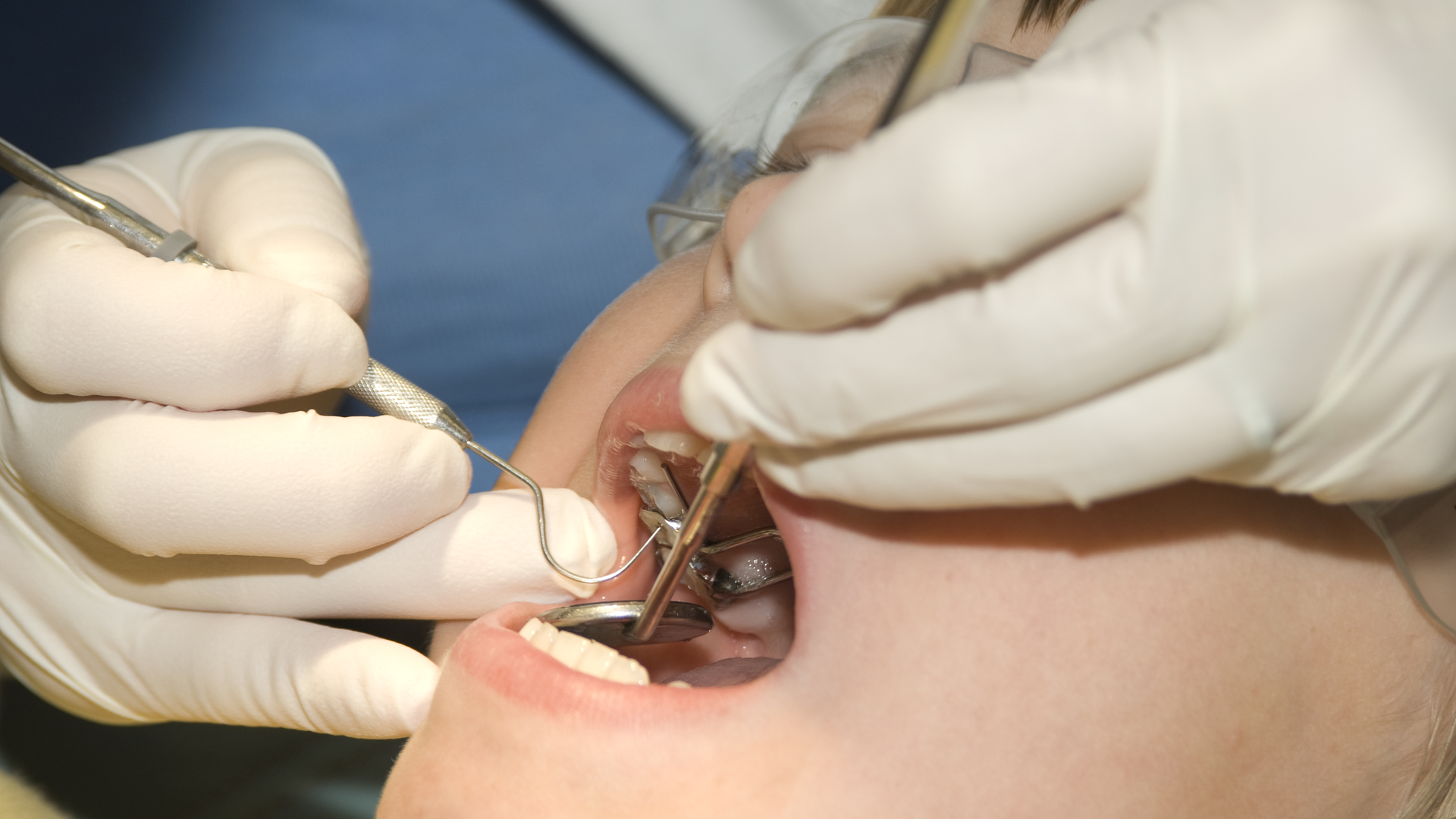 The extraoral and intraoral dental exam process for complete patient