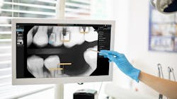 Pearl Image 1 1 622a6b7366562 Pearl Image 1 1 622a6b7366562