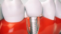 Dreamstime M 79852827 6238c1dc04fa2 Dreamstime M 79852827 6238c1dc04fa2