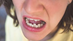 Dreamstime M 136338895 627e64b16c863 Dreamstime M 136338895 627e64b16c863