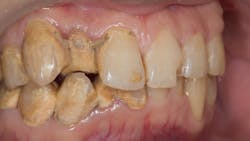 Getty Images 832267882 62aa247631e43 Getty Images 832267882 62aa247631e43