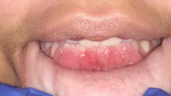 Figure 1: Case presentation Figure 1: Case presentation