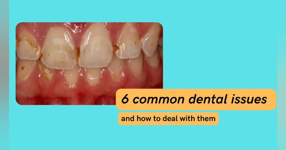 6 common dental problems—and how to fix them | Dentistry IQ