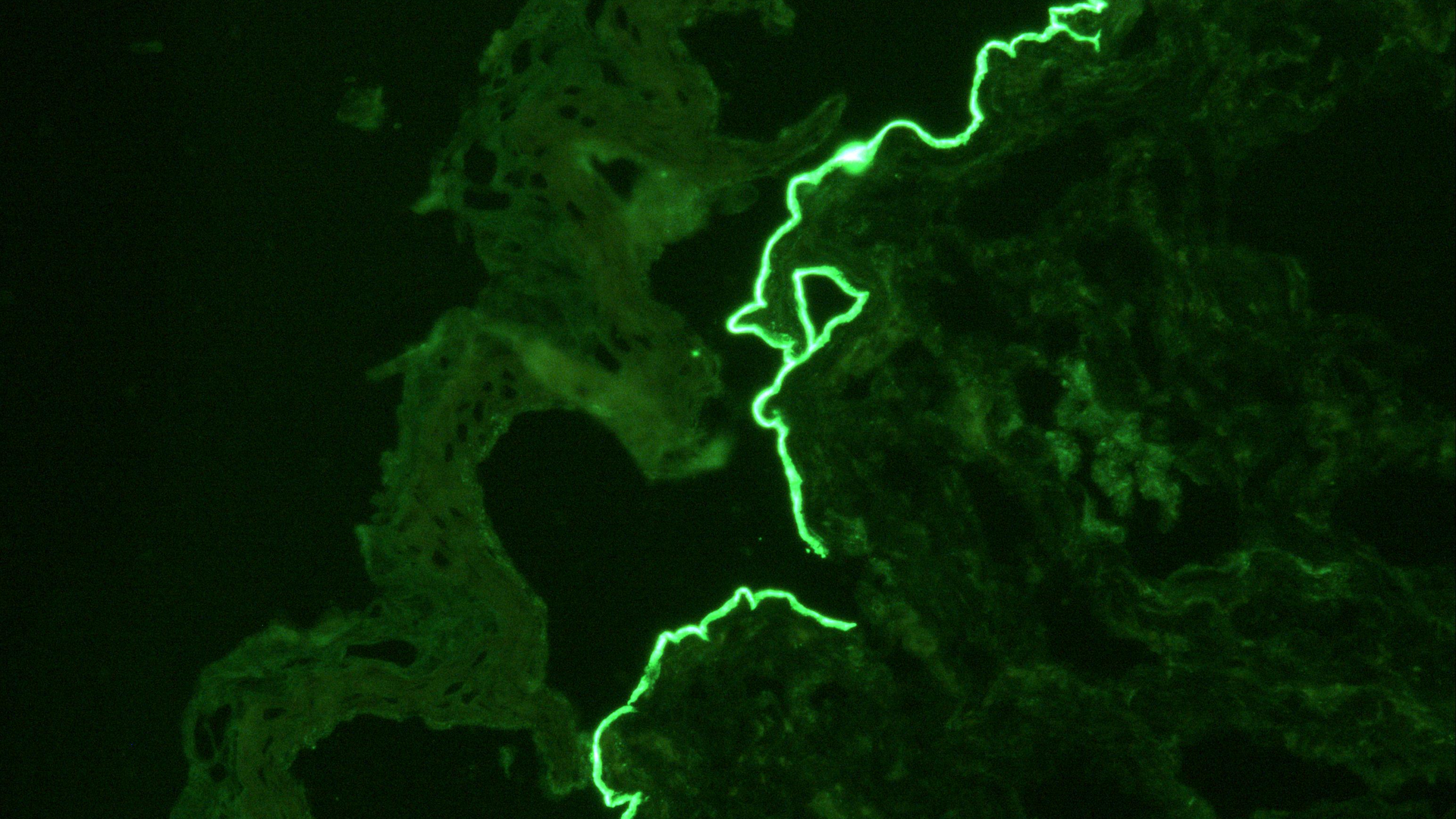 Laminin 332 IIF-IgG4.F