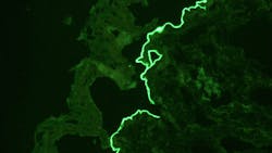 Laminin 332 IIF-IgG4.F Laminin 332 IIF-IgG4.F