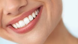 Dreamstime Xl 76139289 636d2787583b5 Dreamstime Xl 76139289 636d2787583b5