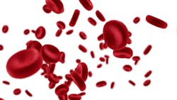 Dreamstime Xl 87719409 636d62e8745e7 Dreamstime Xl 87719409 636d62e8745e7