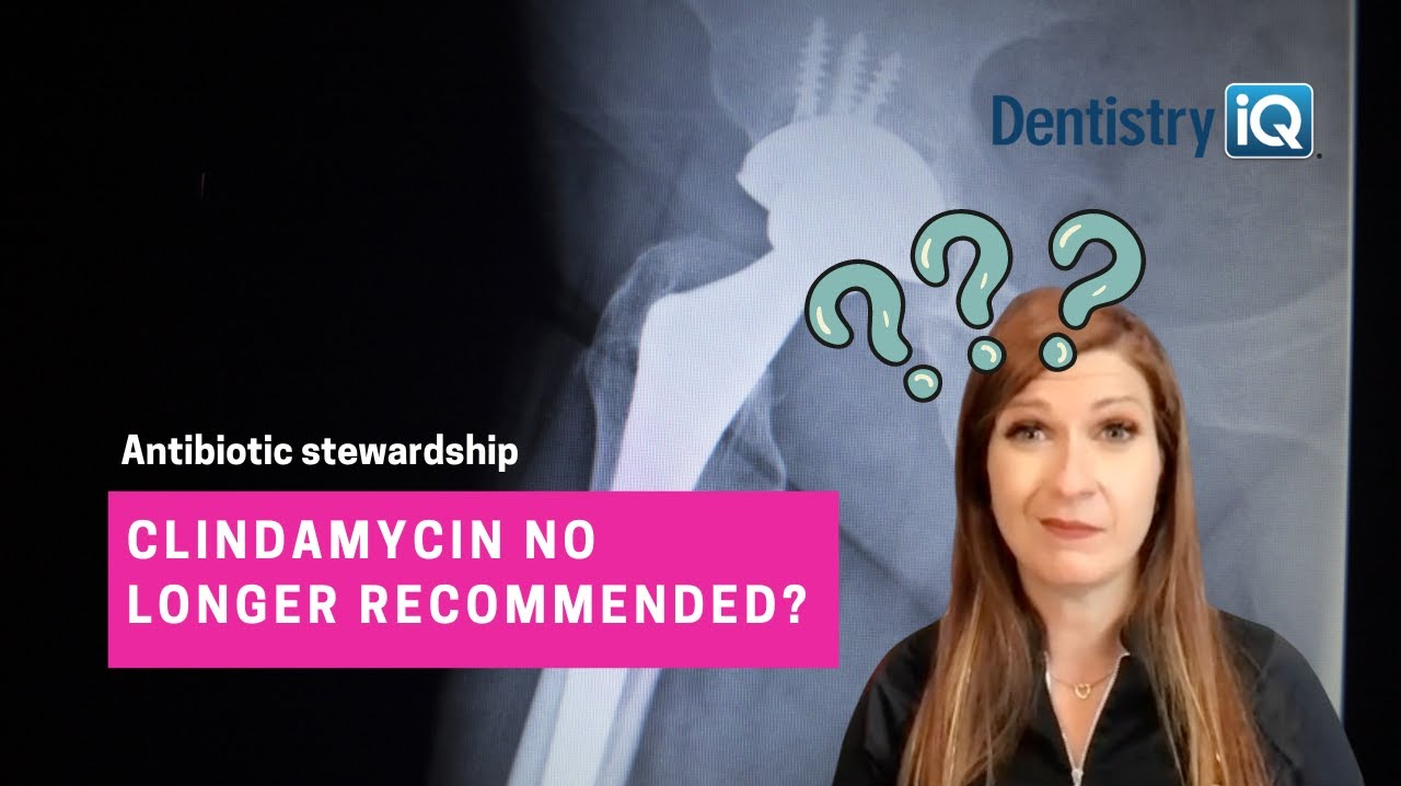 Medical History Mysteries Clindamycin and dental prophylaxis—what's